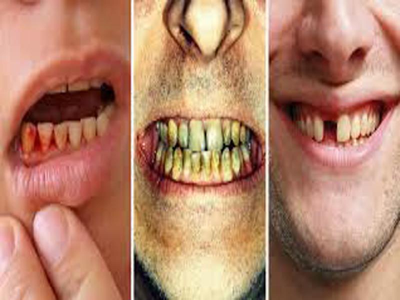 tooth problem