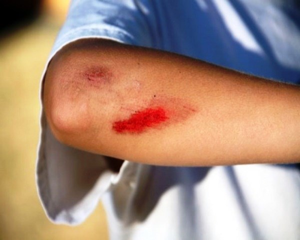 injury