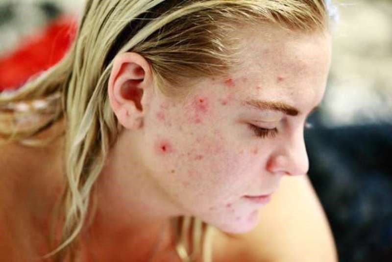 Benefits from castor oil