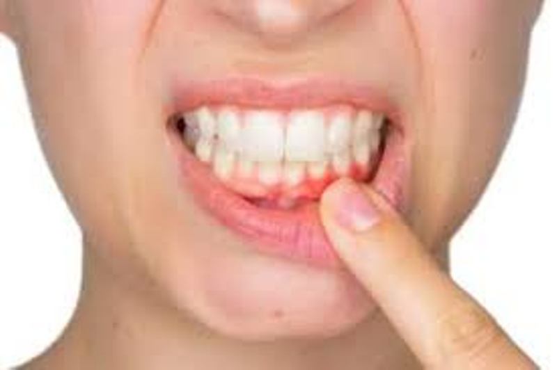teeth