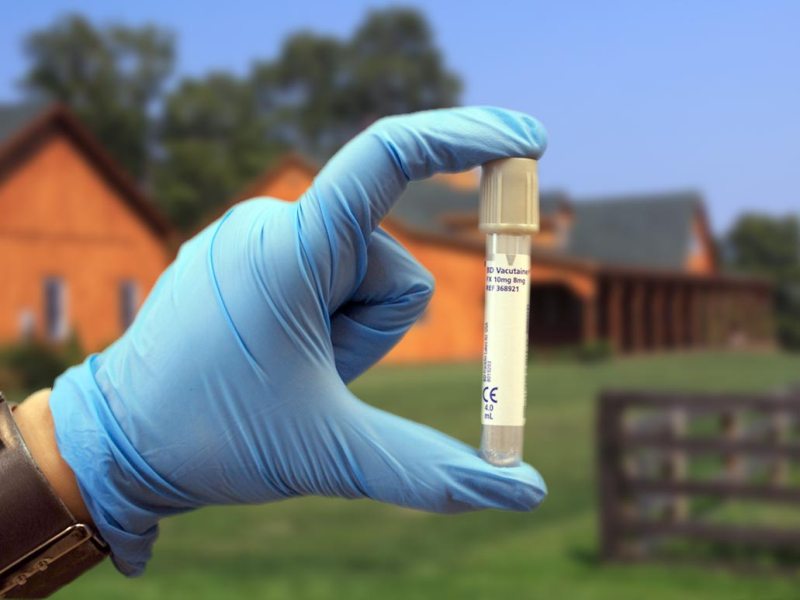 seman test