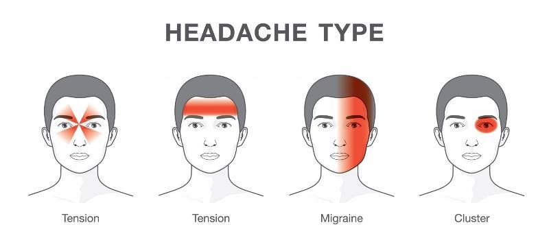 Migraine problem