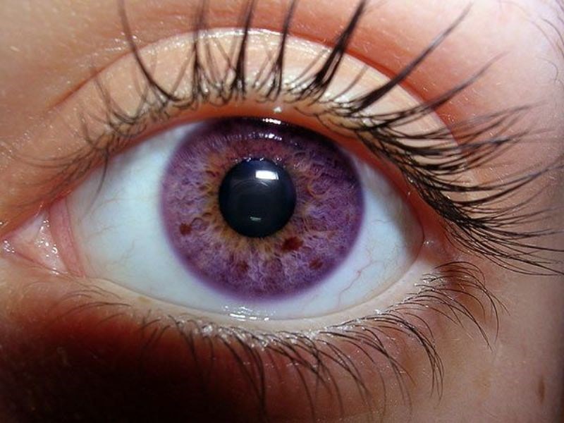 Improve Eyesight