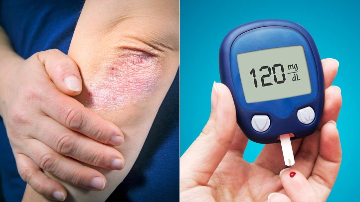 World Diabetes