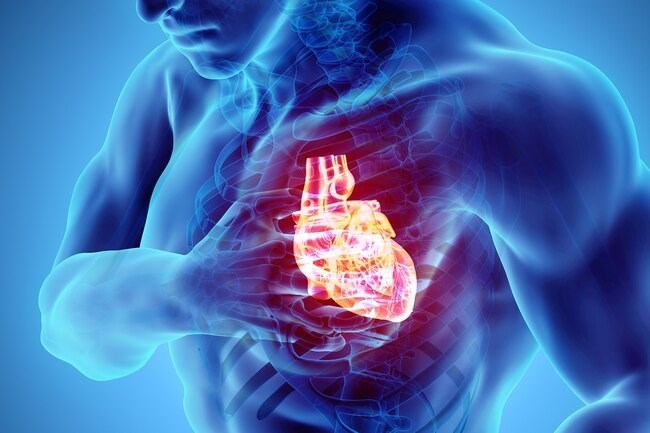 Heart Attack&Cardiac Arrest